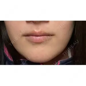 銀座マイアミ美容外科の