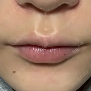 ルラ美容クリニック ルラ美容クリニック 大阪心斎橋院口コミ