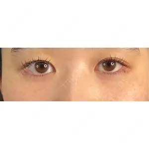 藤・ナチュレ美容クリニック 藤・ナチュレ美容クリニック 銀座院口コミ
