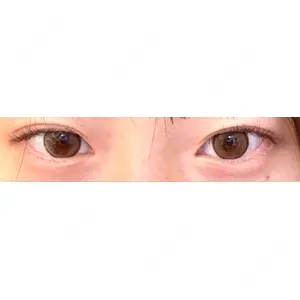 東京シンデレラ美容外科 東京シンデレラ美容外科 池袋院口コミ