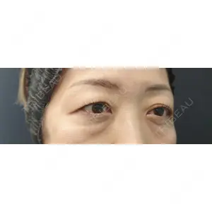湘南美容クリニック 湘南美容クリニック 千葉センシティ院口コミ