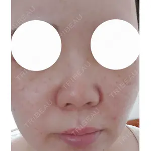 湘南美容クリニック 湘南美容クリニック 新宿南口院口コミ