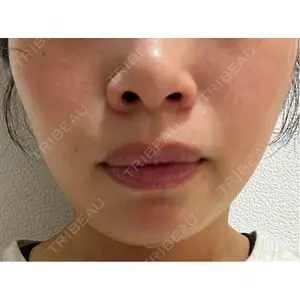 L‘amour clinic Tokyo【ラムールクリニック東京】口コミ