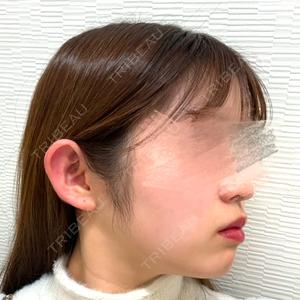 TCB東京中央美容外科 TCB東京中央美容外科 新横浜院口コミ