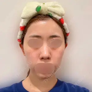 セギム美容整形外科口コミ