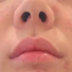 口コミ