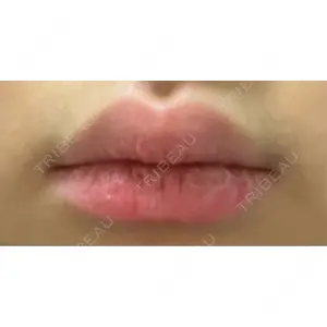 R Beauty CLINIC R Beauty CLINIC 銀座院口コミ