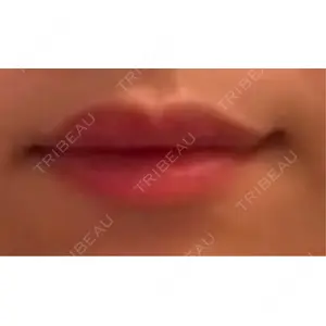 おおたかの森ビューティークリニック口コミ