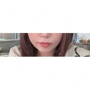 口コミ