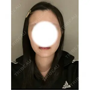 セギム美容整形外科口コミ