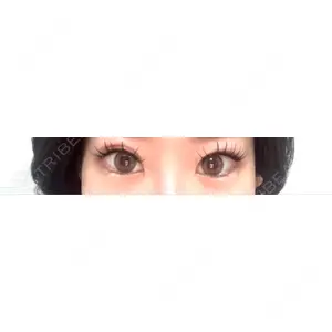 東京シンデレラ美容外科 東京シンデレラ美容外科 池袋院口コミ