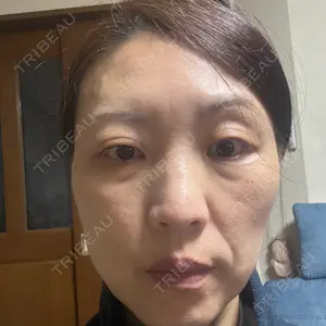 TCB東京中央美容外科 TCB東京中央美容外科 神戸院口コミ