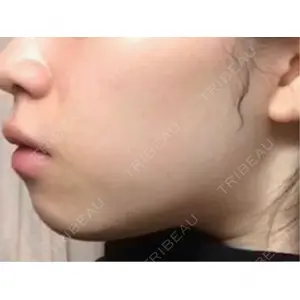 口コミ