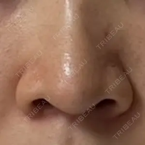 セギム美容整形外科口コミ