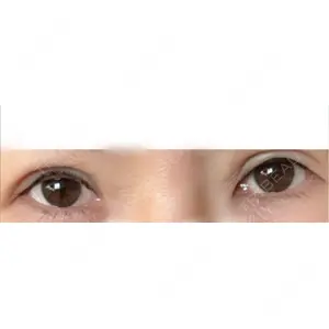 HAAB×DREAM BEAUTY CLINIC HAAB×DREAM BEAUTY CLINIC 大阪梅田院口コミ