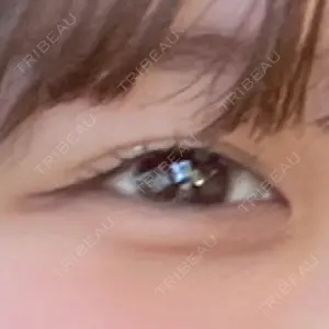 ルラ美容クリニック ルラ美容クリニック 渋谷本院口コミ
