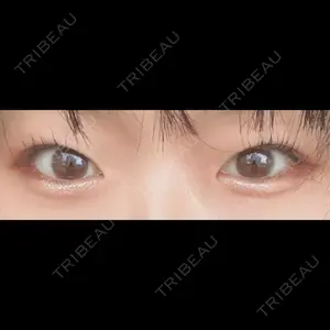 LUHO（ルホ）美容外科口コミ