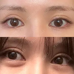 AI Beauty Clinic （エーアイ美容クリニック）口コミ