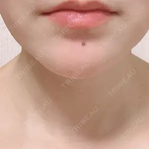 フォンタナクリニック天神口コミ