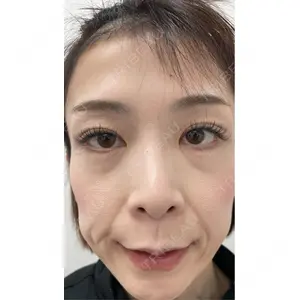 TCB東京中央美容外科 TCB東京中央美容外科 神戸院口コミ