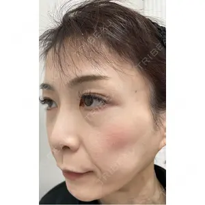 TCB東京中央美容外科 TCB東京中央美容外科 神戸院口コミ