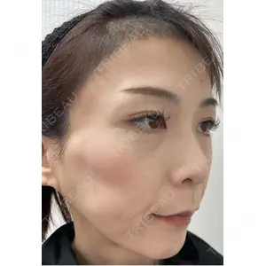 TCB東京中央美容外科 TCB東京中央美容外科 神戸院口コミ