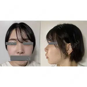 LUHO（ルホ）美容外科口コミ