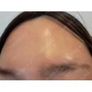 TCB東京中央美容外科 TCB東京中央美容外科 池袋駅前院口コミ