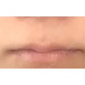 口コミ