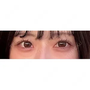 東京シンデレラ美容外科 東京シンデレラ美容外科 池袋院口コミ