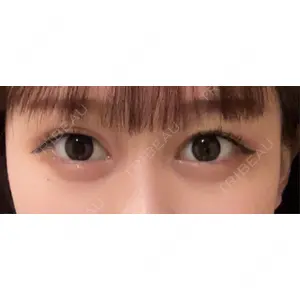 HAAB×DREAM BEAUTY CLINIC HAAB×DREAM BEAUTY CLINIC 大阪梅田院口コミ