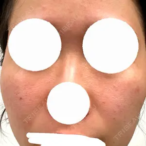 RAISE CLINIC 【レイズクリニック】口コミ