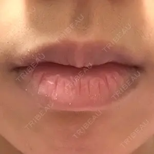 ルラ美容クリニック ルラ美容クリニック 大阪本院口コミ