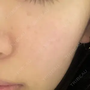 ジュノビューティークリニック 新宿院口コミ