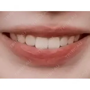 麻布十番クレールデンタルクリニック口コミ