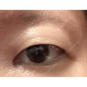 東京シンデレラ美容外科 東京シンデレラ美容外科 大宮院口コミ