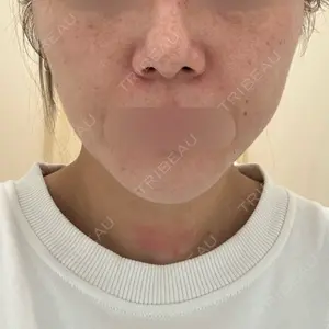 湘南美容クリニック 湘南美容クリニック 博多院口コミ