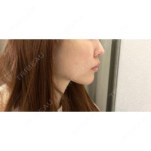 TCB東京中央美容外科 TCB東京中央美容外科 豊橋院口コミ