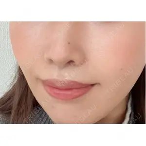 R Beauty CLINIC R Beauty CLINIC 銀座院口コミ