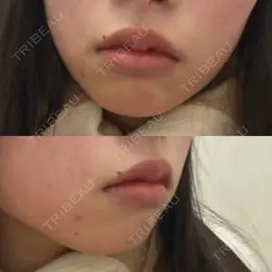 ルラ美容クリニック ルラ美容クリニック 大阪心斎橋院口コミ