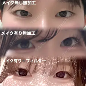 水の森美容クリニックの口コミ