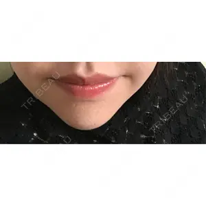 R Beauty CLINIC R Beauty CLINIC 銀座院口コミ