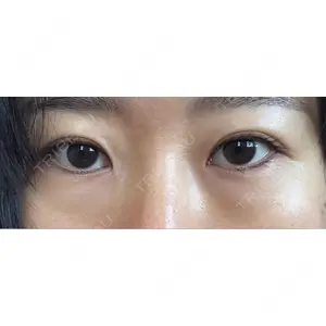 東京シンデレラ美容外科 東京シンデレラ美容外科 池袋院口コミ