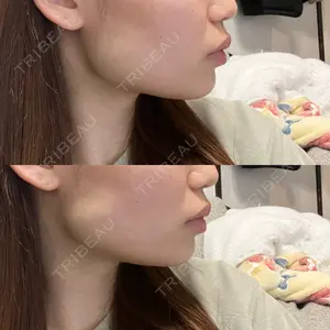 おおたかの森ビューティークリニック おおたかの森ビューティークリニック口コミ