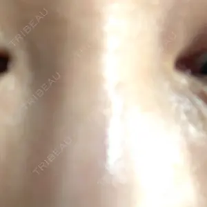 ルラ美容クリニック ルラ美容クリニック 大宮院口コミ