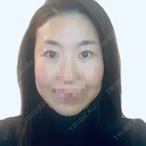口コミ