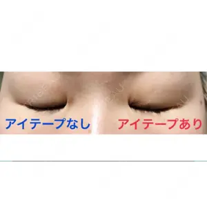 口コミ
