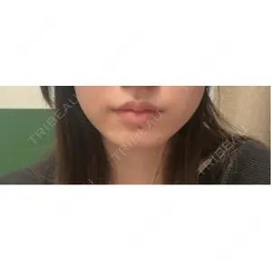 PRO CLINIC プロクリニック 銀座院口コミ