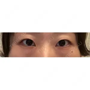 口コミ
