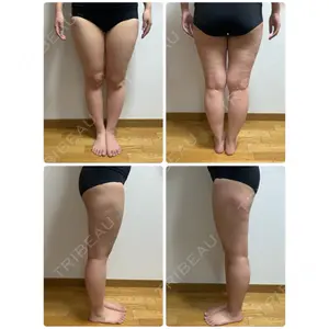 湘南美容クリニック 湘南美容クリニック 新橋銀座口院口コミ